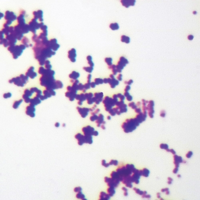 Mixed Gram-Positive & Gram-Negative Coccus, w.m. Gram Stain Microscope Slide