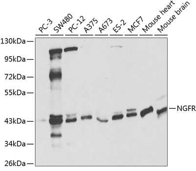 Anti-NGFR Antibody