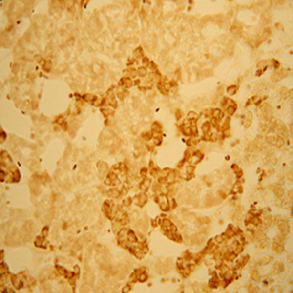 Vesicular Monoamine Transporter 2 Rabbit Antibody