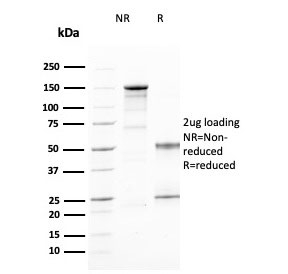 SDS-PAGE analysis of purified, BSA-free CD25 antibody (clone IL2RA/2394) as confirmation of integrity and purity.