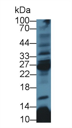 Western Blot; Sample: Rat Thymus lysate; Primary Ab: 3µg/ml Rabbit Anti-Human CD8b Antibody Second Ab: 0.2µg/mL HRP-Linked Caprine Anti-Rabbit IgG Polyclonal Antibody