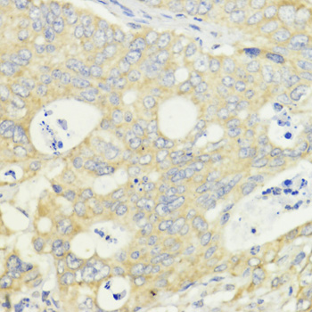 Anti-EEF1A1 Antibody