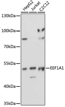 Anti-EEF1A1 Antibody