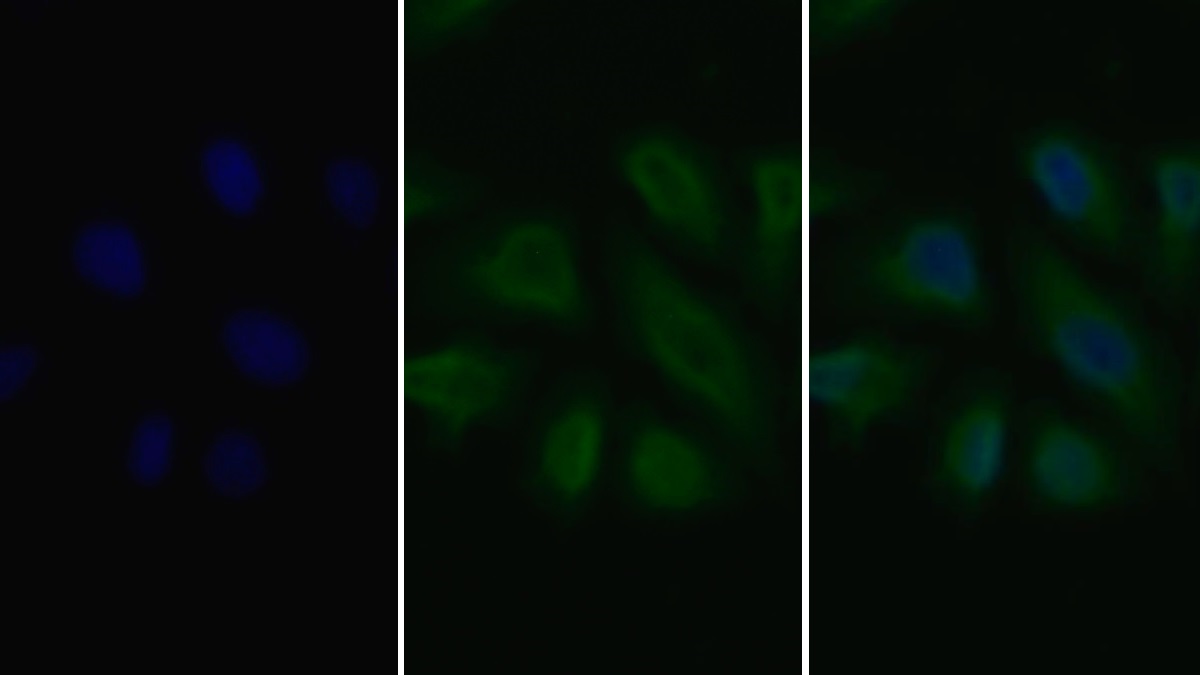 FITC staining on IF; Sample: Human MCF7 cell;  Primary Ab: 20µg/ml Mouse Anti-Human VEGFR2 Antibody Second Ab: 5µg/ml FITC-Linked Caprine Anti-Mouse IgG Polyclonal Antibody (Catalog: SAA544Mu18)