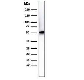 Western blot testing of His-tagged protein with Histidine antibody.