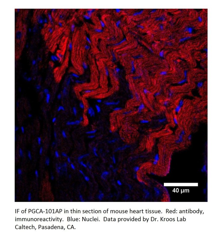 Anti-PGCA Antibody