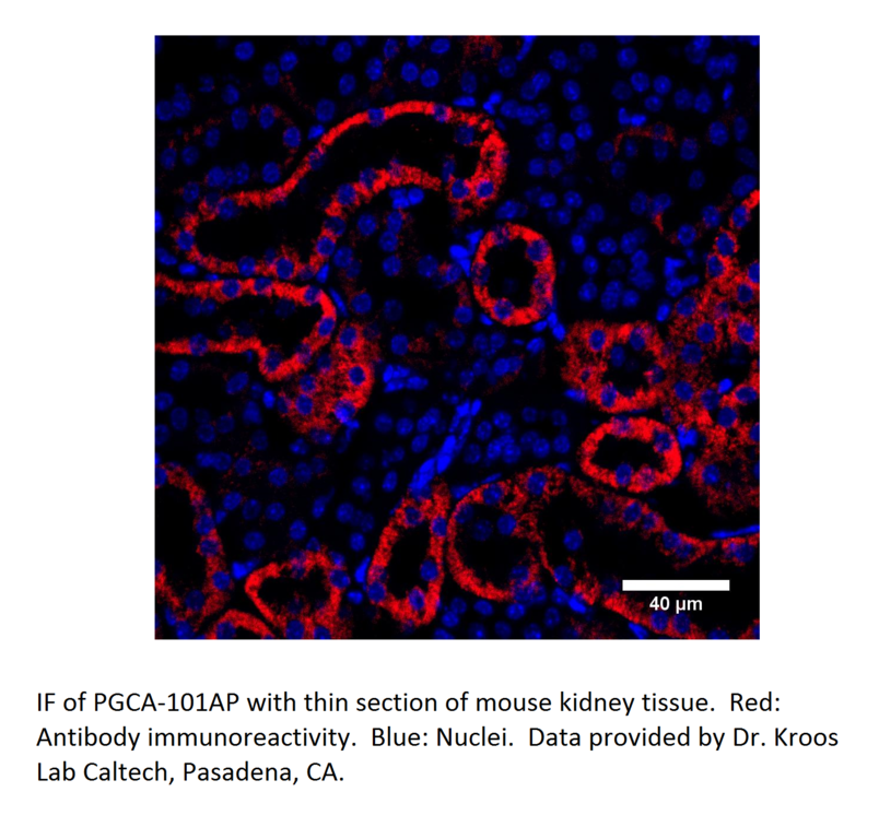Anti-PGCA Antibody