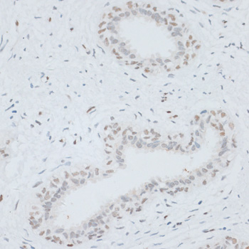 Anti-HMGB1 Antibody