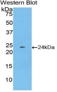 Western Blot; Sample: Recombinant protein.