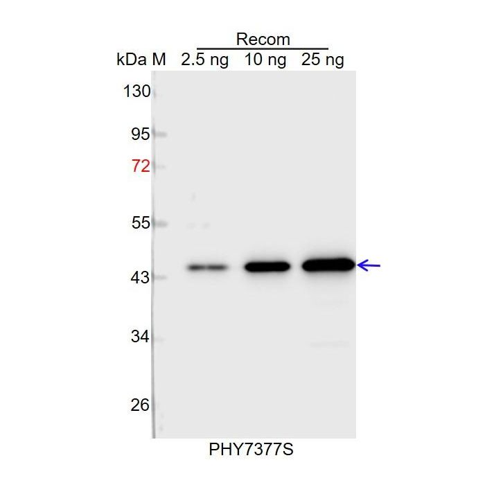 AER / Anti-NADPH-Dependent Oxidoreductase 2-Alkenal Reductase Antibody