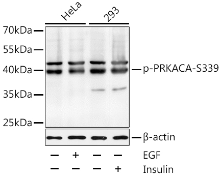 Anti-PRKACA (phospho S339) Antibody
