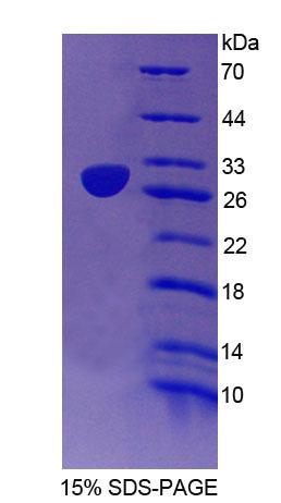 Figure. SDS-PAGE