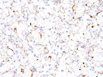 Anti-TIM3 Antibody [IHC003]