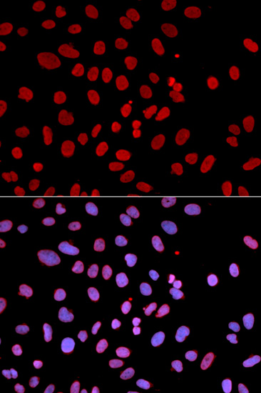 Anti-PTPN6 Antibody