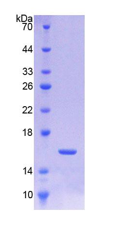 Figure. SDS-PAGE
