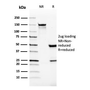 SDS-PAGE analysis of purified, BSA-free VISTA antibody as confirmation of integrity and purity.