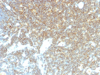 IHC staining of FFPE human lymph node with CD48 antibody (clone CD48/4785). HIER: boil tissue sections in pH 9 10mM Tris with 1mM EDTA for 20 min and allow to cool before testing.