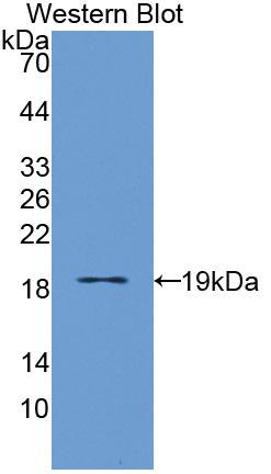 Western Blot; Sample: Recombinant protein.