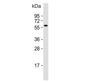 Western blot testing of human CCRF-CEM cell lysate with CLEC4F antibody. Predicted molecular weight ~66 kDa.
