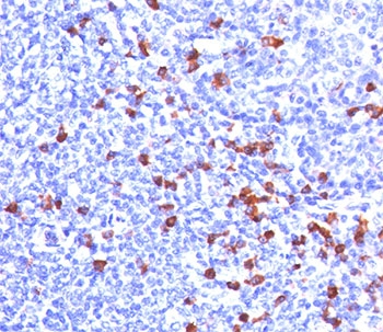 IHC testing of human tonsil stained with anti-Kappa light chain antibody (clone KLC709). 