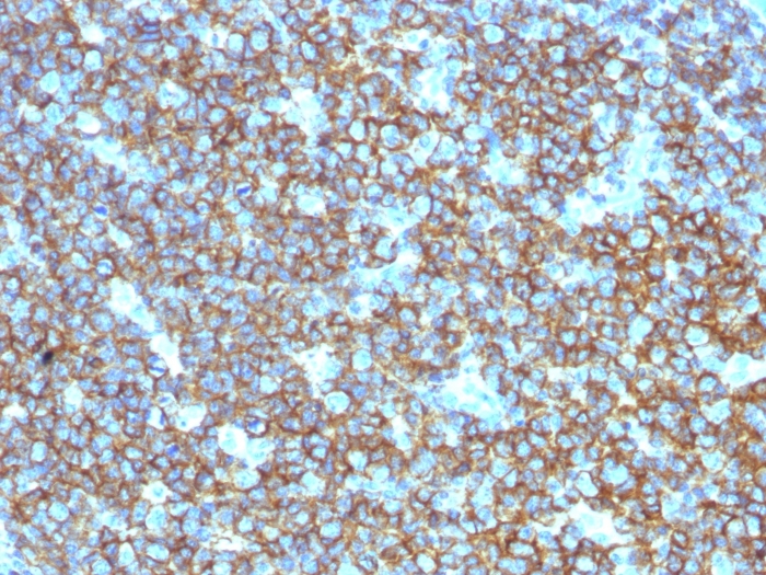 Anti-CD20 Antibody - BSA and Azide free