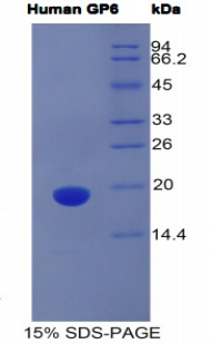 Figure. SDS-PAGE