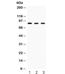 Western blot testing of 1) rat skeletal muscle, 2) mouse brain and 3) human HeLa lysate with Aconitase 2 antibody at 0.1ug/ml. Predicted/observed molecular weight: ~85 kDa.