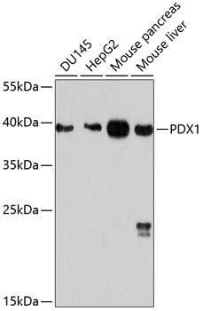 Anti-PDX1 Antibody
