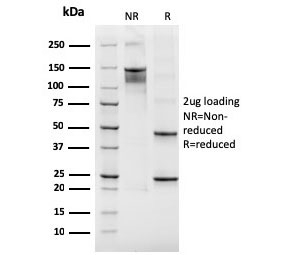 SDS-PAGE analysis of purified, BSA-free recombinant ITGB3 antibody as confirmation of integrity and purity.
