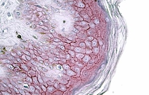 Anti-DSG1 Antibody