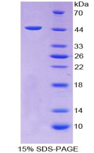 Figure. SDS-PAGE