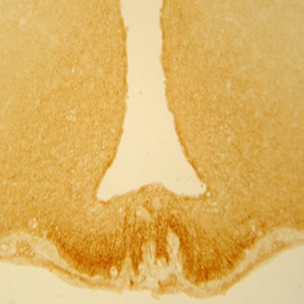 Somatostatin Antibody