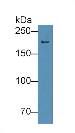 Western Blot; Sample: Mouse Spleen lysate; Primary Ab: 2µg/mL Rabbit Anti-Mouse NUP210 Antibody Second Ab: 0.2µg/mL HRP-Linked Caprine Anti-Rabbit IgG Polyclonal Antibody