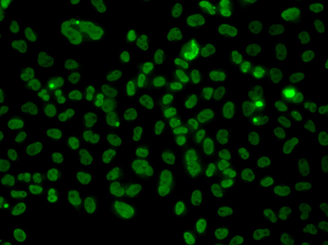 Anti-PLCXD2 Antibody