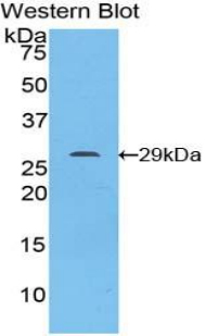 Western Blot; Sample: Recombinant protein.
