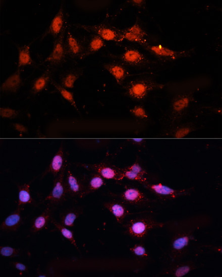 Anti-CTBP2 Antibody