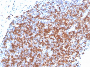 IHC staining of FFPE human tonsil with recombinant ZAP70 antibody. HIER: boil tissue sections in pH 9 10mM Tris with 1mM EDTA for 20 min and allow to cool before testing.