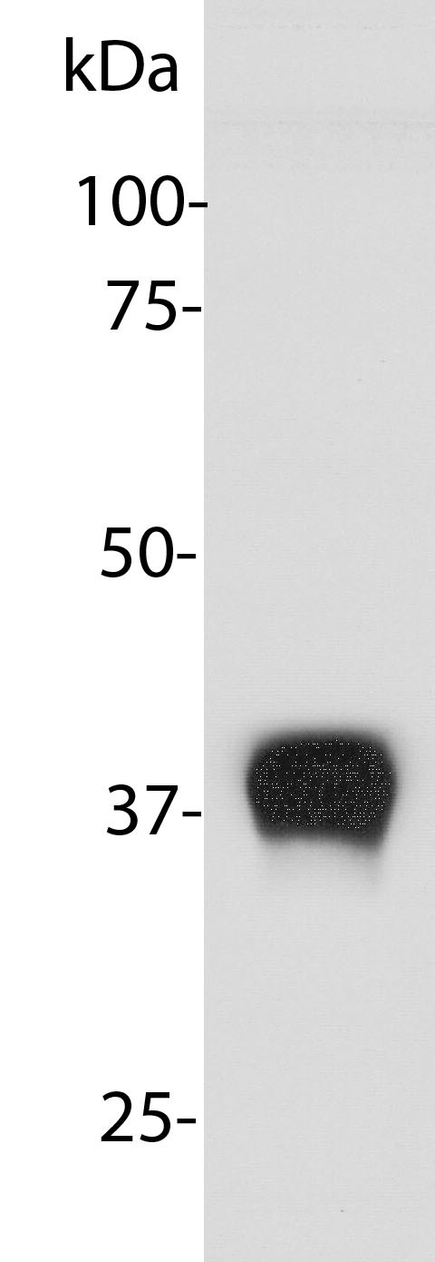 Anti-Aldolase A + Aldolase B + Aldolase C Antibody [E9]