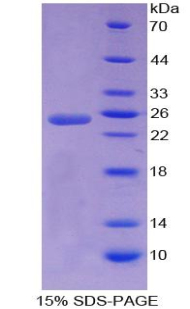Figure. SDS-PAGE