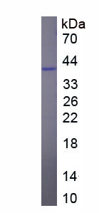 Figure. SDS-PAGE