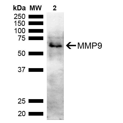 MMP9 Antibody: FITC