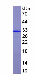 Figure. SDS-PAGE