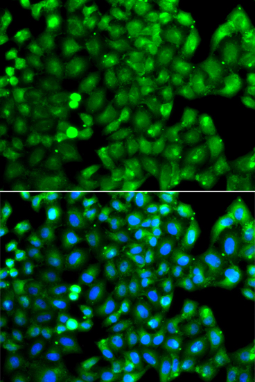 Anti-HLA-DRB1 Antibody