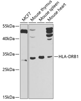 Anti-HLA-DRB1 Antibody