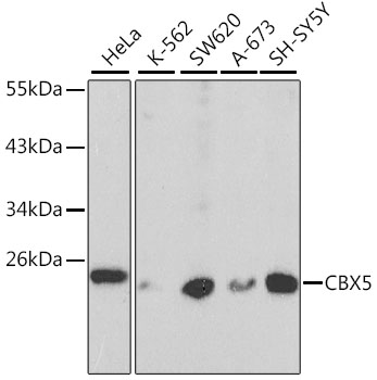 Anti-CBX5 Antibody
