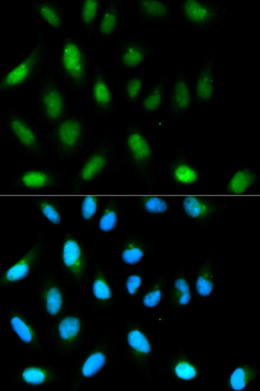 Anti-CBX5 Antibody