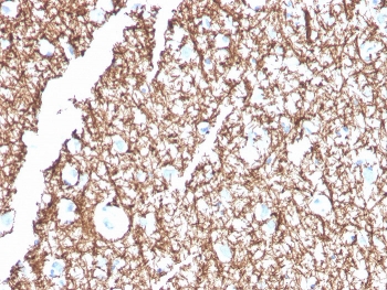 IHC staining of FFPE human brain with MBP antibody. HIER: boil tissue sections in pH 9 10mM Tris with 1mM EDTA for 20 min and allow to cool before testing.