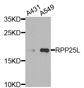 Anti-RPP25L Antibody