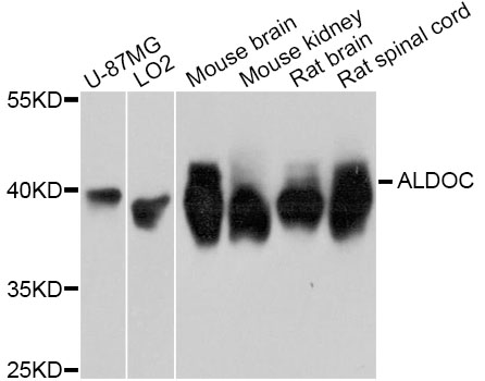 Anti-ALDOC Antibody
