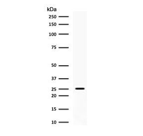 Western blot testing of human PC3 cell lysate with C1QA antibody (clone CCSA-1). Predicted molecular weight ~26 kDa.
